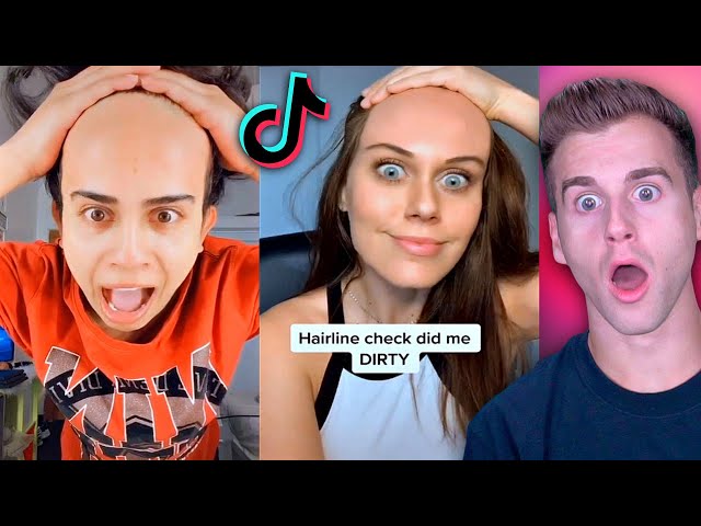 Really BAD Hairline Check 2..(Tik Tok Compilation)