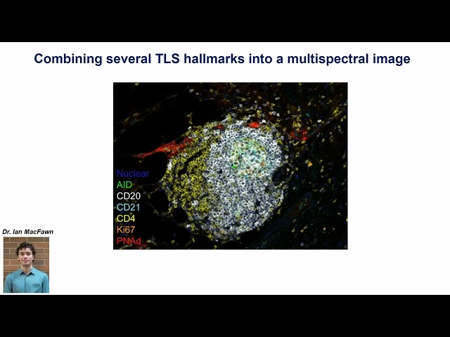 Tertiary lymphoid structures to the forefront of immunotherapy: what are they good for?