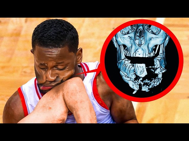 Most DANGEROUS Injuries in NBA..