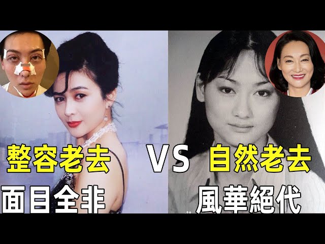 同樣是60+，對比8位老牌女星，整容老去和自然老去的差別就出來了！#娛樂CIA