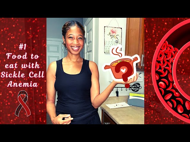 The #1 food you should eat with Sickle Cell Anemia