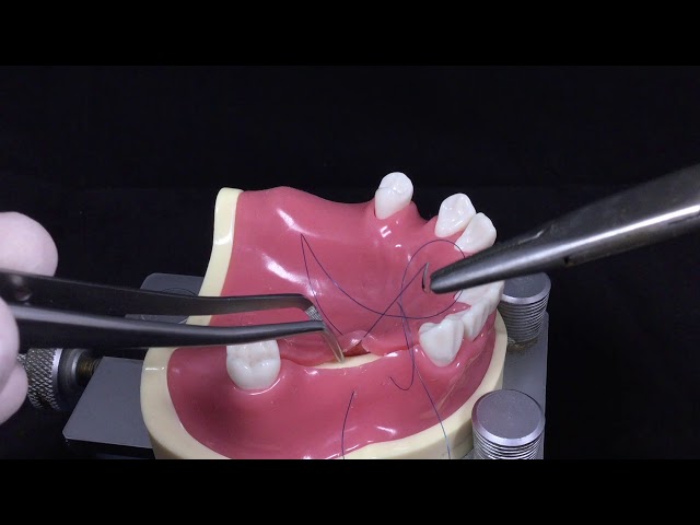 Horizontal External Mattress suture #9 - Back to the suture