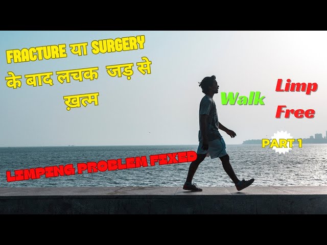 How To Walk Without Limping After Fracture || Tips & Exercises Part-1