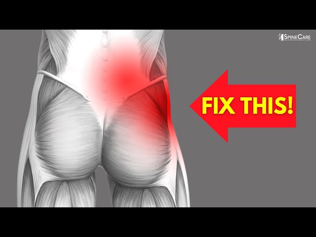 How to Fix One-Sided Lower Back and Hip Pain