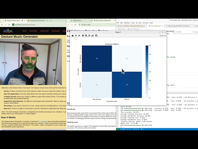 Achieving 96.6% Accuracy in Seizure Detection with Optimized Training: Confusion Matrix Insights