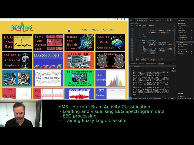 Biomedical Data Tools Live Development: HMS - Harmful Brain Activity Classification