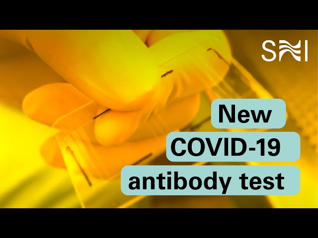 New antibody test for Covid-19