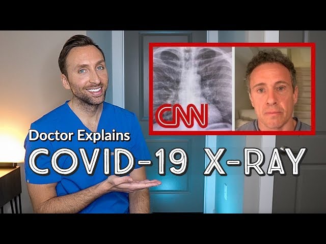 DOCTOR Explains COVID-19 Chest X-ray | Coronavirus - CNN Chris Cuomo