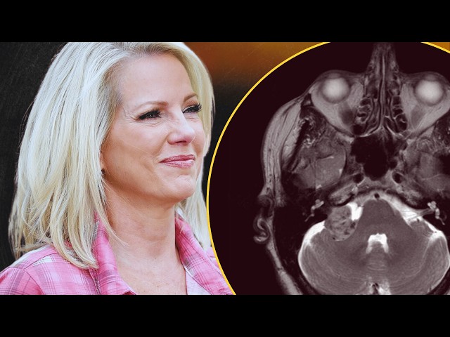 Shannon Bream Opens up About the Disease That Almost Took Her Life