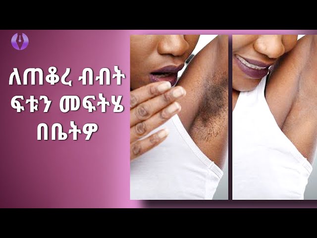 ለጠቆረ ብብት,አንገት,ጉልበት የሚያነፃ ፍቱን መፍትሄ  | How to brighten knees,underarms and elbow | Ethiopia