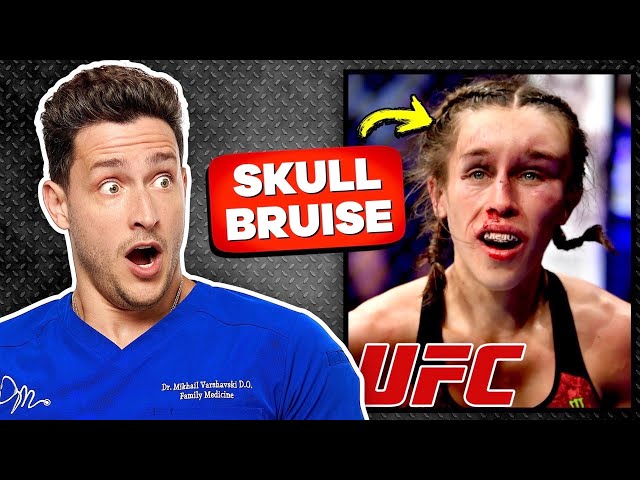 Doctor Reacts To Painful UFC MMA Injuries