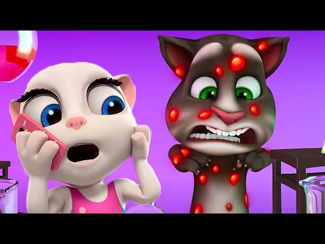 Talking Tom 🐱 Llama al doctor 🔥 Super Toons TV Dibujos Animados en Español