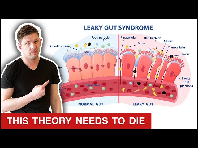 LEAKY GUT is a BIG FAT HOAX