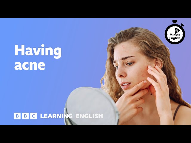 Having acne ⏲️ 6 Minute English