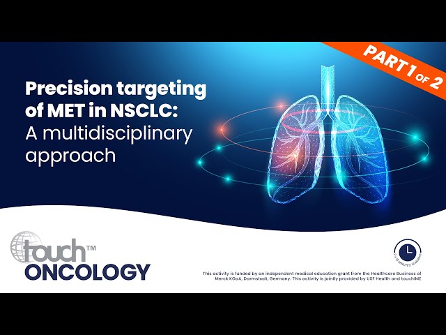 Precision targeting of MET in NSCLC: A multidisciplinary approach