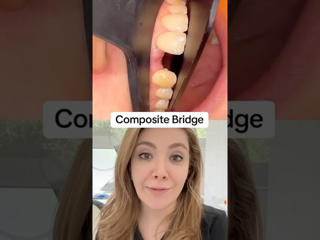 How Does Composite Bridge Look Like?!