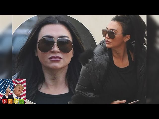 Lauren Goodger sports bruising over neck after visiting cosmetic surgery clinic  Breaking News