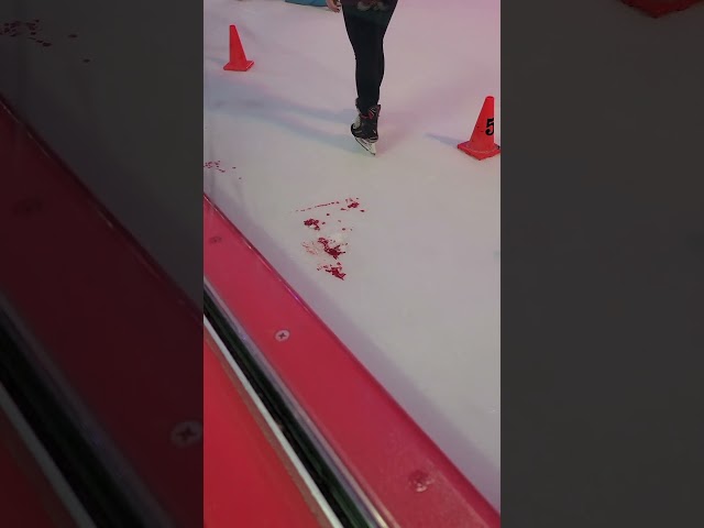 Ice Skating has its dangers