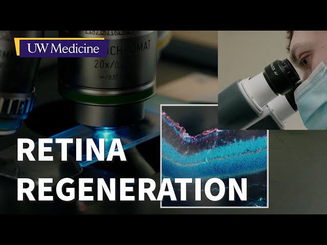 Progress toward regenerating damaged retina cells | UW Medicine