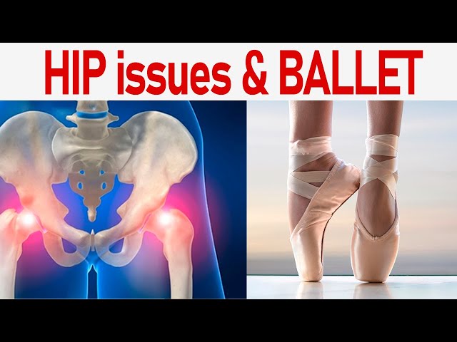 I quit ballet because of my hip.. my story.