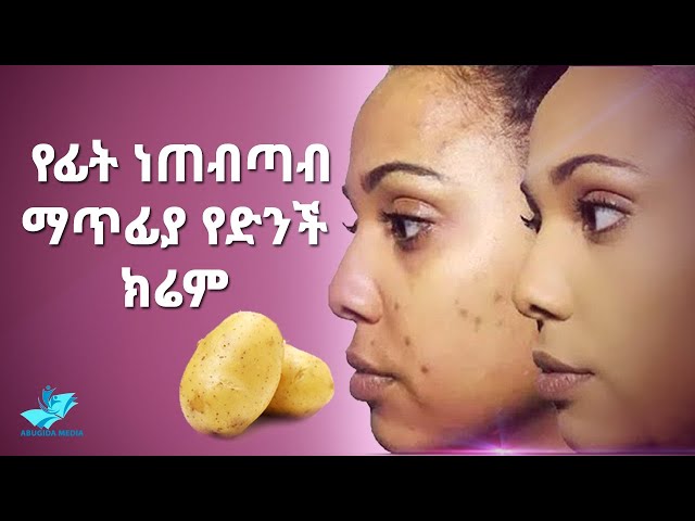 Ethiopia:- በ7 ቀን በድንች ፊታችንን ማጥሪያ ቀላል ዘዴ | Removing Dark Spots In 7 Days 100% Natural