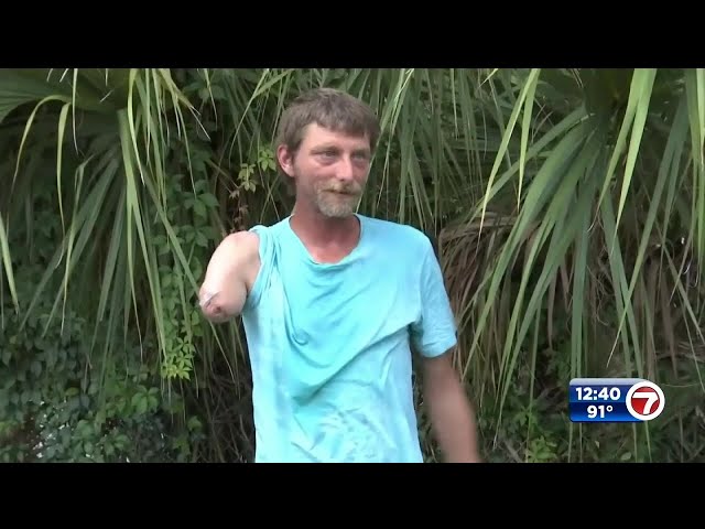 Florida man who lost arm in alligator attack speaks out