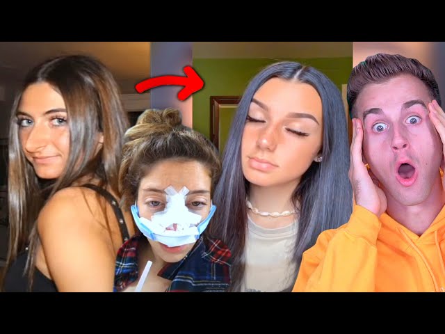 Ultimate NOSE JOB Transformation Check..(Tik Tok Compilation)