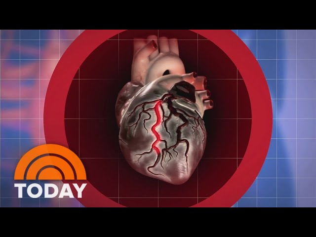 Why are young, healthy adults experiencing a rise in heart attacks?