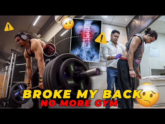 My Life's Worst Injury! ⚠️🤕 | NO MORE GYM😭