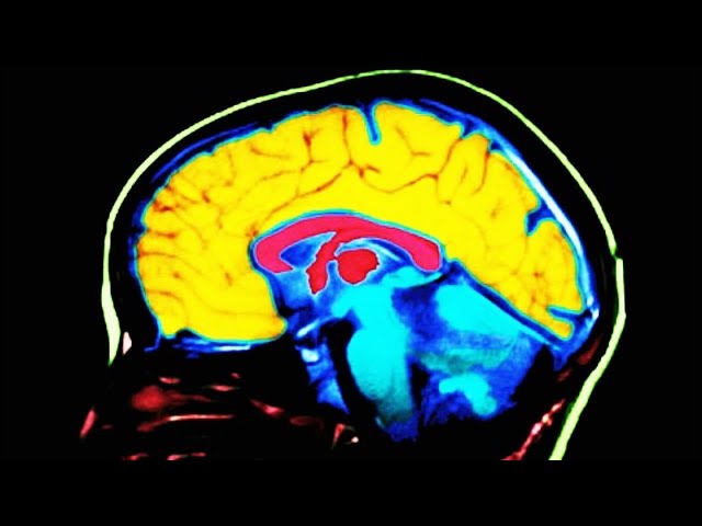 Study Finds This Key Difference In Conservative Brains