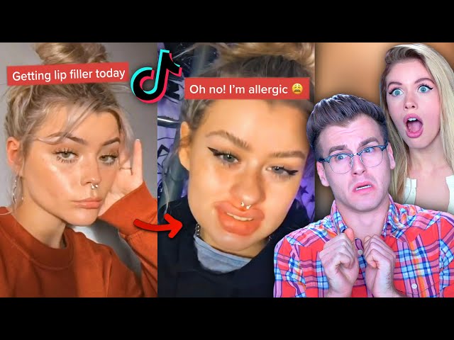 INSANE Lip Filler Check GONE WRONG..(Tik Tok Compilation)