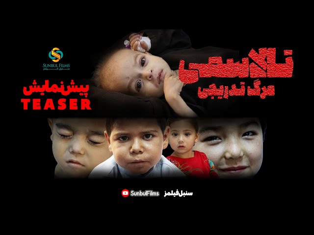 Teaser Of 'Thalassemia: The Gradual Death' Documentary - پیش نمایش مستند «تالاسمی: مرگ تدریجی» سنبل