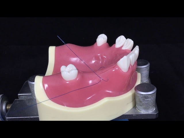 Horizontal Internal Mattress suture #5 - Back to the suture