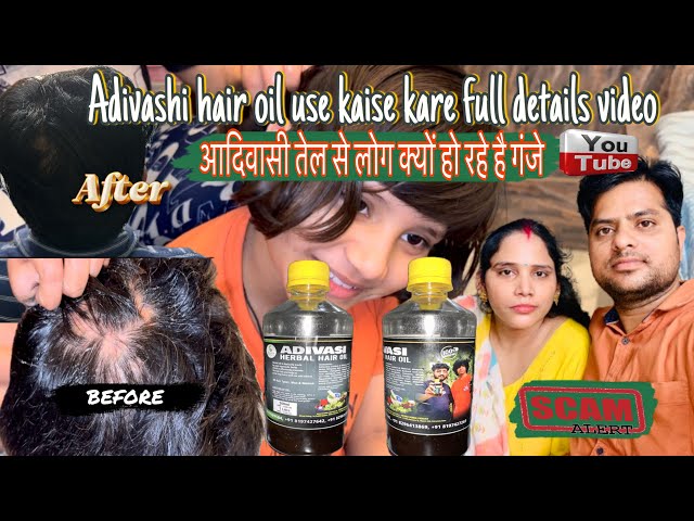 आदिवासी तेल से क्यों लोग हो रहे है गंजे || Adivasi oil kaise use kare | #adivasi #trending #yt #love