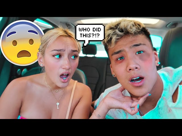 I Got Beat Up Prank On CRUSH.. (FREAK OUT)