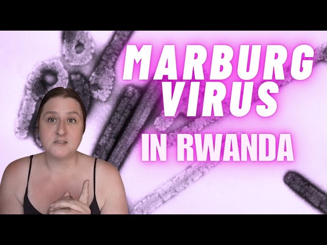 Marburg in Rwanda - Should You Worry?