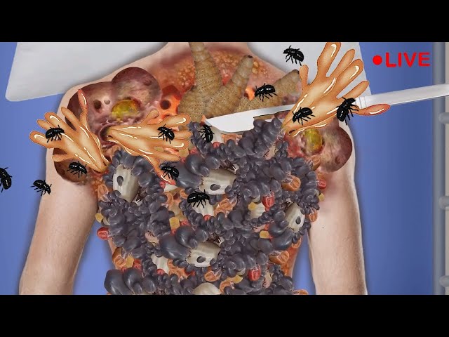 🔴 "Relaxo ASMR:LIVE ASMR REMOVE WORM COLLECTION TREATMENT ANIMATION