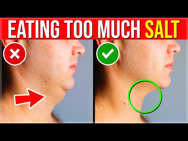 9 ALARMING Signs You Are Eating TOO MUCH SALT (High Sodium Intake)