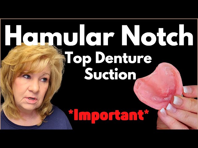 Top Denture Suction HAMULAR NOTCH Explained