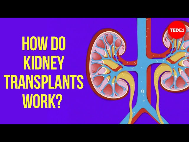 How do kidney transplants work? - Alexander H. Toledo