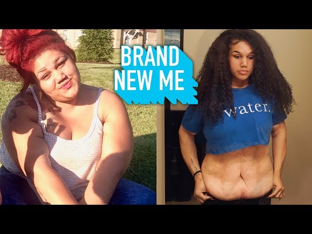 I Lost 200lbs But Felt Trapped In My Excess Skin | BRAND NEW ME