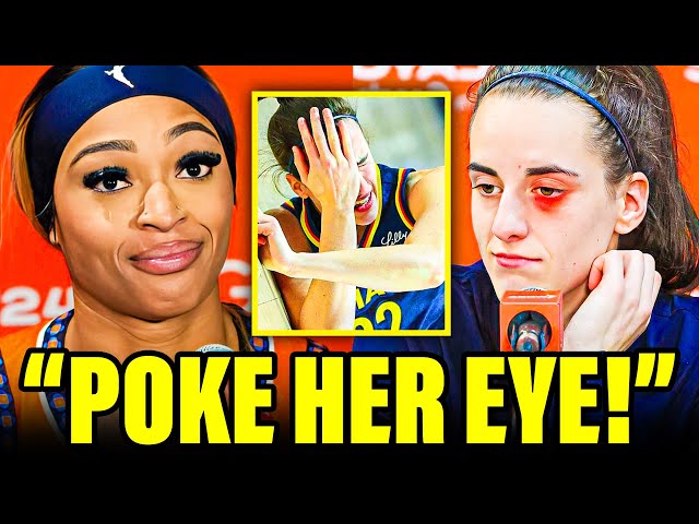 Caitlin Clark Racist Bullies Gets Worse With a Poke in the Eye