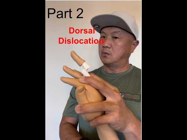 Dorsal dislocation reduction technique #2 | Sports Medicine | Athletic Training | navy Medicine |