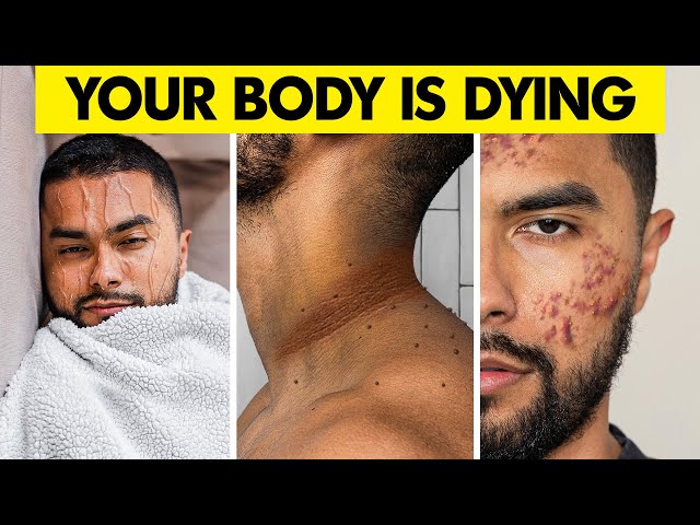 Signs Your Body Is Dying