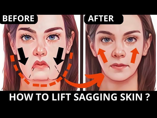 🛑 🔥 LIFT SAGGING SKIN EXERCISE | REDUCE NASOLABIAL FOLDS | CHEEKS LIFT, JOWLS, FOREHEAD, FROWN LINES