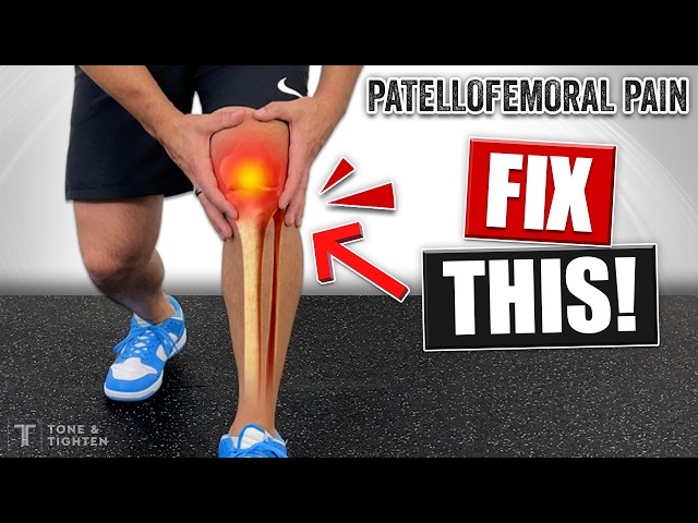 Fix Your Kneecap Pain! [Exercises For Patellofemoral Syndrome]