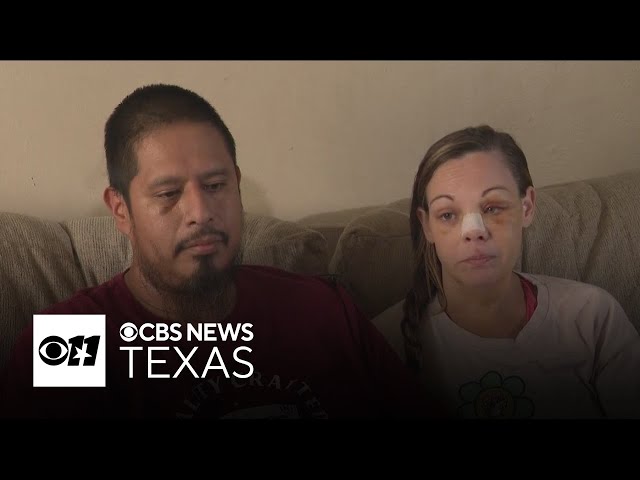 North Texas couple recovering from attack at Dallas Cowboys game