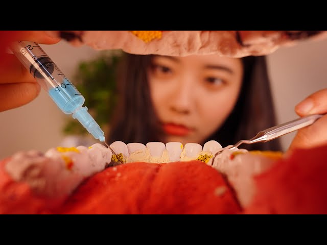 ASMR VR 180 Cavity treatment and Scaling Dentist Roleplay [ENG SUB]