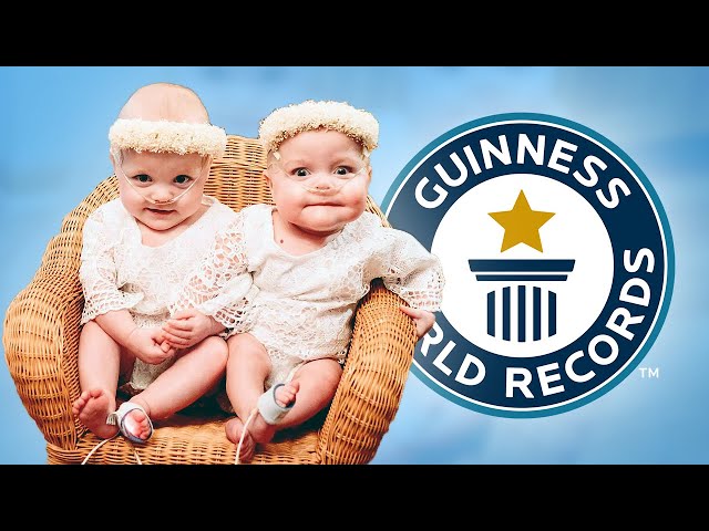 Most Premature Twins - Guinness World Records