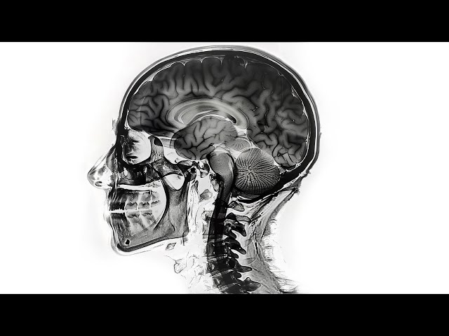 This Video is About Brain Rot